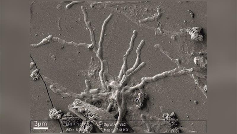 Dipartimento di Scienze Roma Tre - Scoperti neuroni nel cervello di una vittima dell'eruzione del 79 d.C.